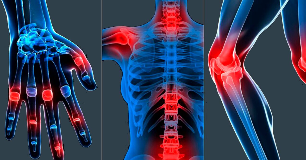 Indicações de uso do extrato de Boswellia em cápsulas
