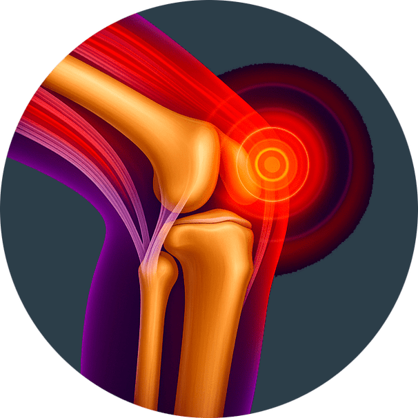Inflamação articular