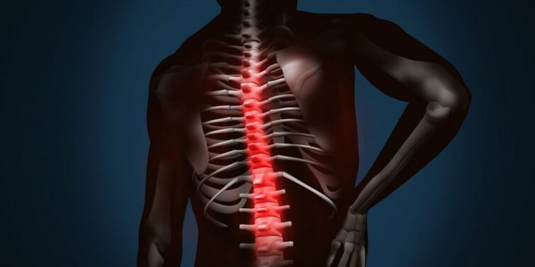 lesões espinhais devido à osteocondrose